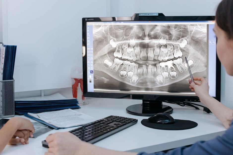 Checking whether dental insurance covers wisdom teeth removal